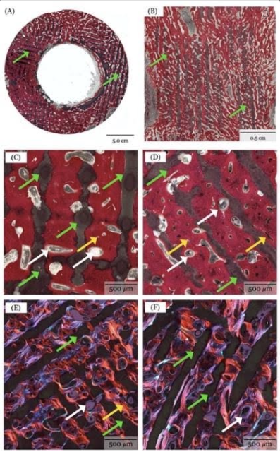 Advanced 3D printing techniques enable the fabrication of patient-specific bioceramic scaffolds with precise architecture and tunable properties that are well-suited for craniofacial bond reconstruction.