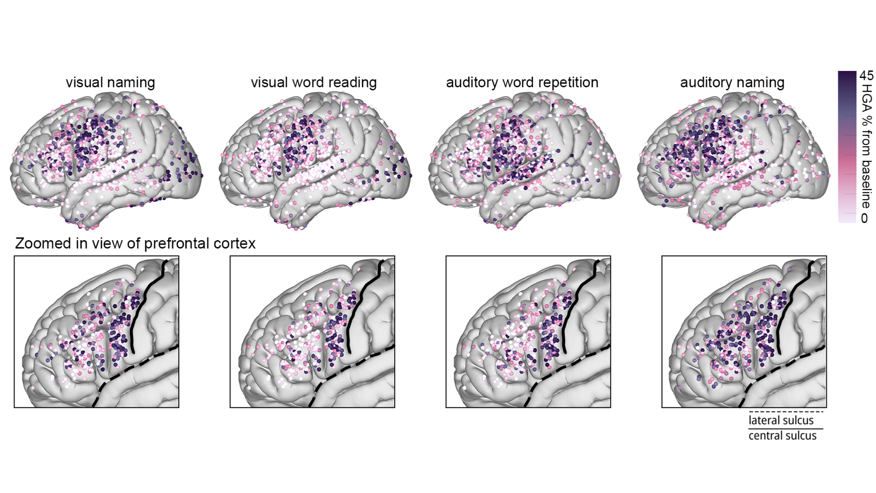 Generative Naming Task Mapping a new brain network for naming | NYU Tandon School of Engineering