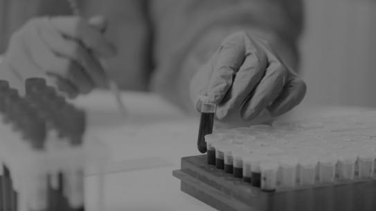 gloved person testing blood in lab