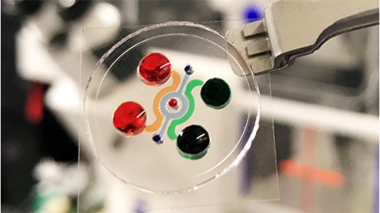Microfluidic organ-on-a-chip