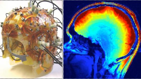 Helmet with Circuits and Thermal Image of Brain