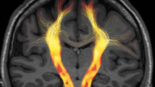 Brain Activity Highlighted 