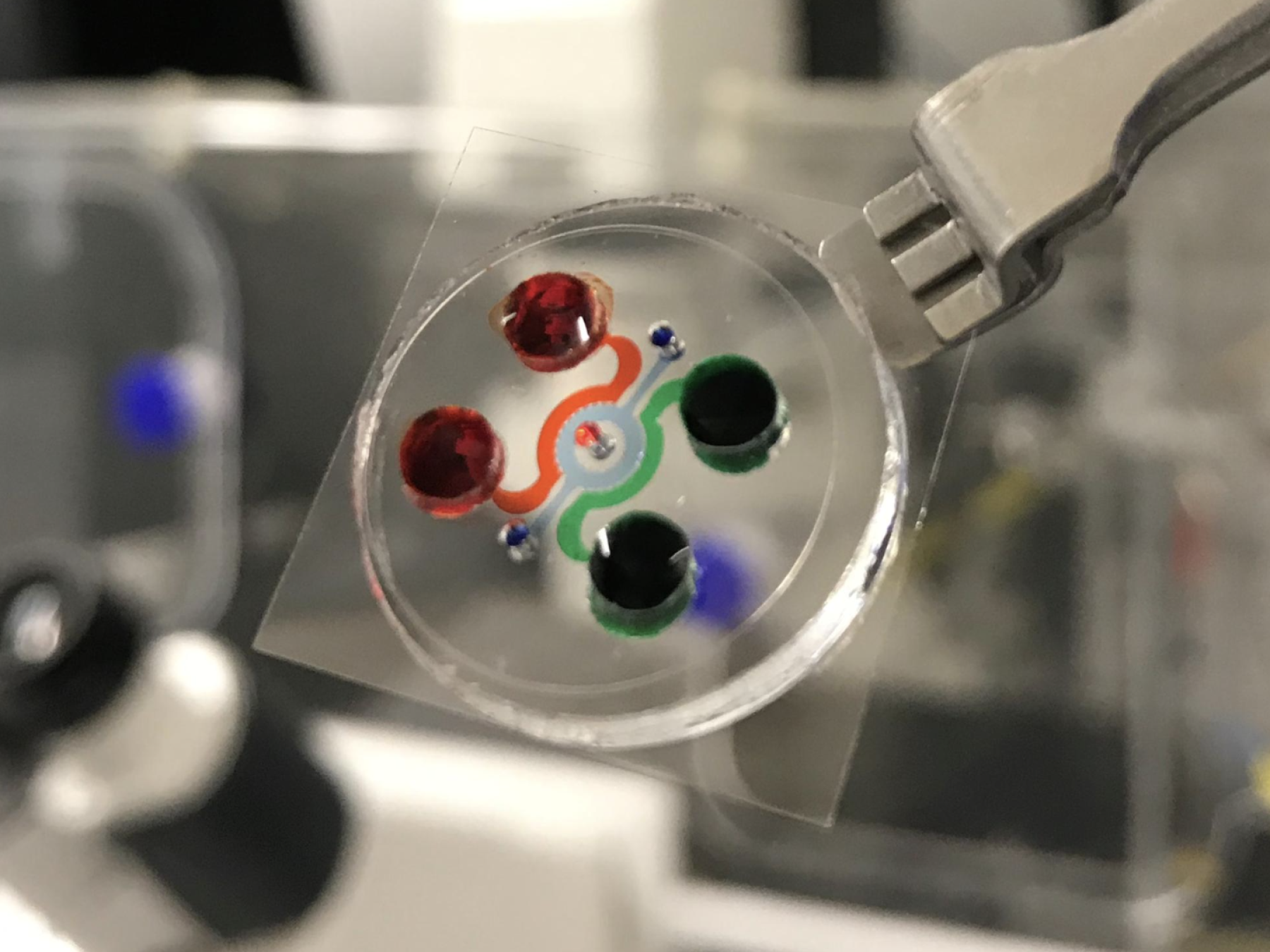 A ‘Cancer Lab’ on Chip: Transforming Cancer Diagnosis and Treatment ...