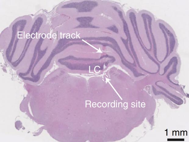 diagram of a Mouse Brain sliced through Center