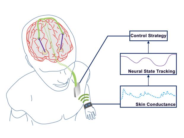 Imagine of Smartwatch interfacing with Neural Network of Brain