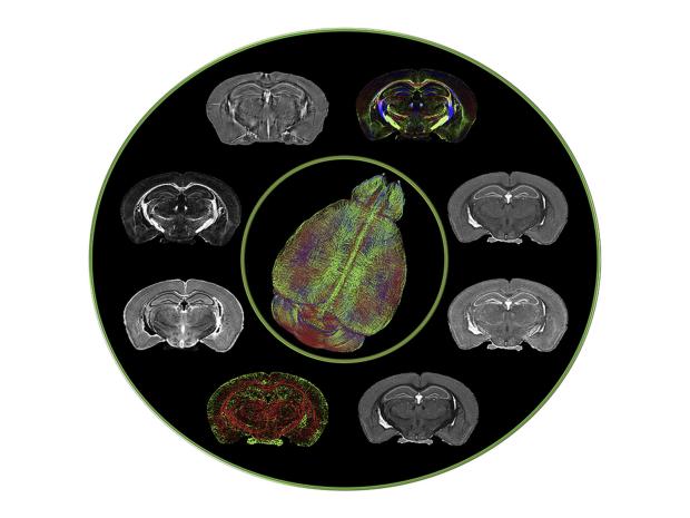 Different MRI images of an embryonic mouse brain