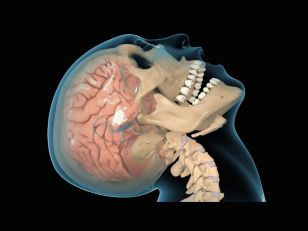 Depiction of Human brain and Skeleton under human skin 