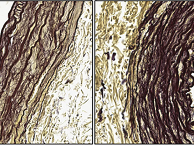 Modified Hart-stained histological images showing whole tissue section of aorta 