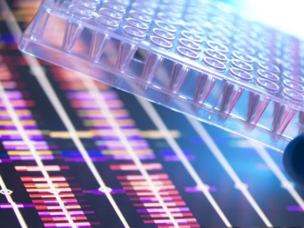 close up of scientist holding a multi well plate that contains DNA samples with the DNA profiles on a computer screen