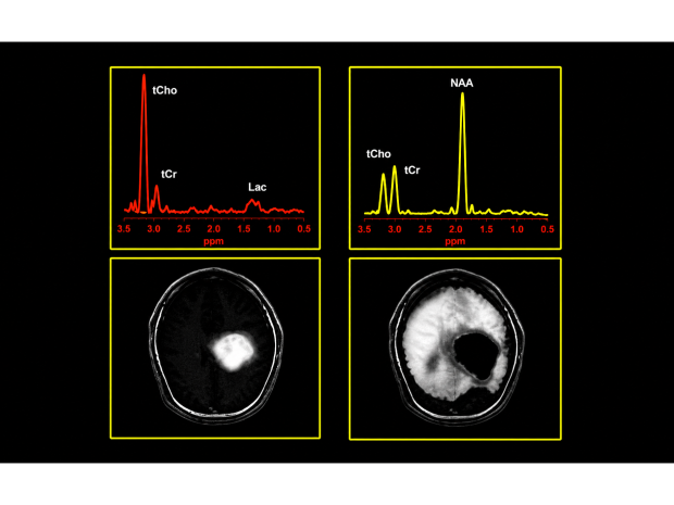 Brain scans being depicted with graphs