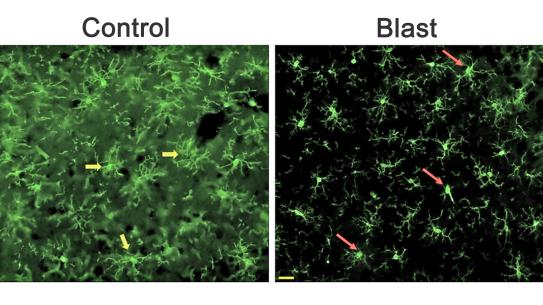 Representative images of the total number and activated form of microglia in animals exposed to rLLB