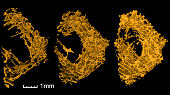 Three-dimensional micro-CT images of trabecular bones 