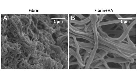 Images of fibrin Fibers