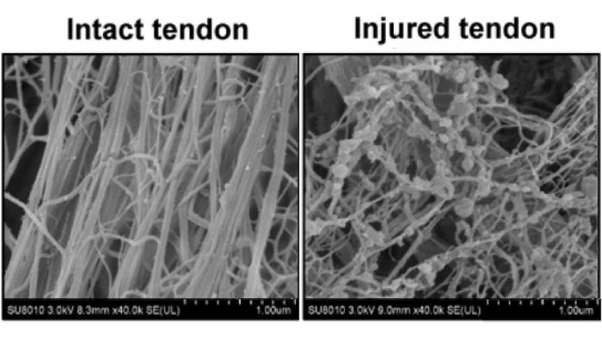 Image of a Tendon and Injured Tendon