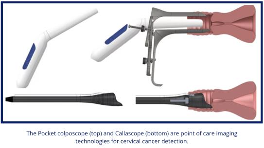The Pocket colposcope (top) and Callascope (bottom) 