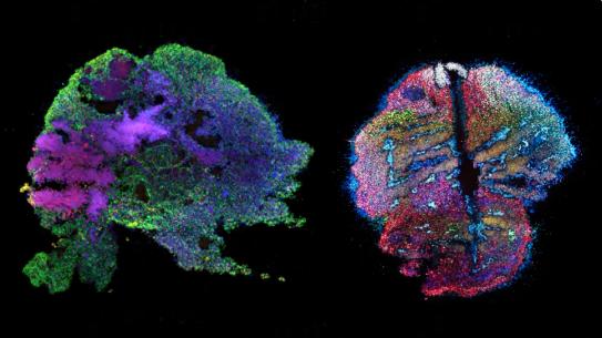 Side-by-side fluorescence images of patterned organoid