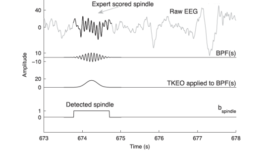  The detection of a spindle using a Butterworth bandpass ﬁlter (BPF) and the TKEO Operator.