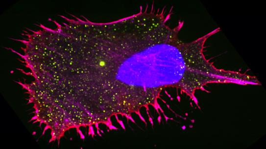 a pancreatic cancer cell 