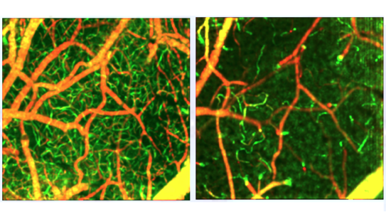 image of blood flow at the capillary level