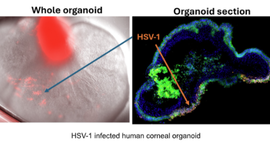 Whole human corneal organoid and organoid section showing HSV-1 infections.