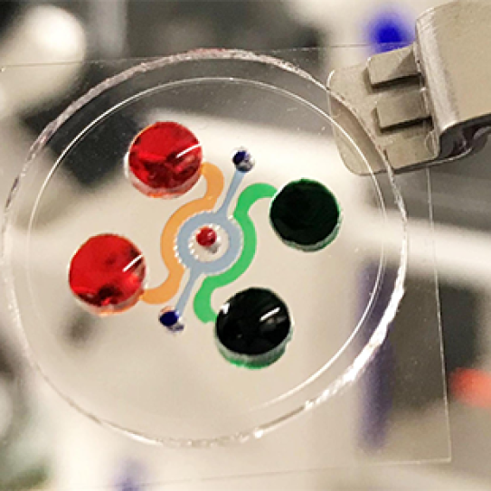 Microfluidic organ-on-a-chip